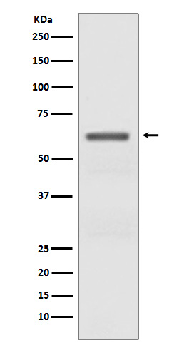 AMPK alpha (Phospho-Thr172) Rabbit mAb 