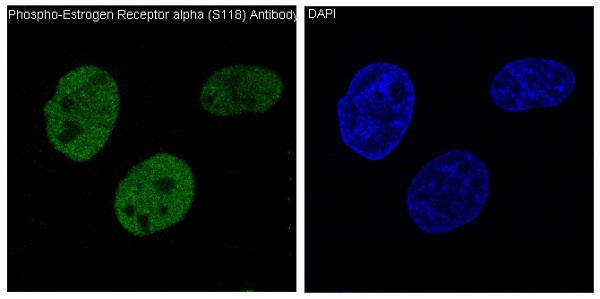 ER alpha (Phospho-Ser118) Rabbit mAb