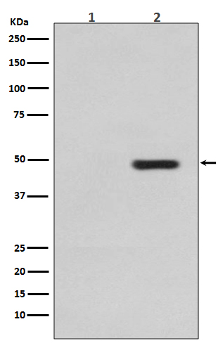 Tau (Phospho-Thr231) Rabbit mAb