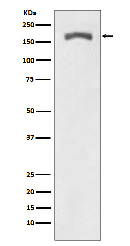 PDGF Receptor beta (Phospho-Tyr740) Rabbit mAb