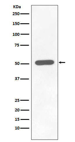 Chk1 (Phospho-Ser296) Rabbit mAb