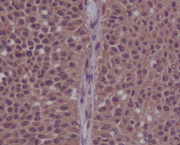 CDK2 (Phospho-Tyr15) Rabbit mAb