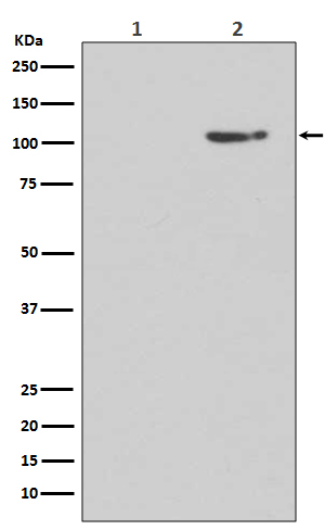 GluR1 (Phospho-Ser845) Rabbit mAb