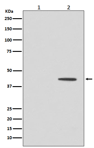 MEK1 (Phospho-Thr292) Rabbit mAb