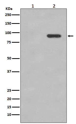 beta Catenin (Phospho-Ser33/Ser37) Rabbit mAb