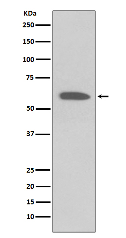 Akt(Phospho-Ser473) Rabbit mAb