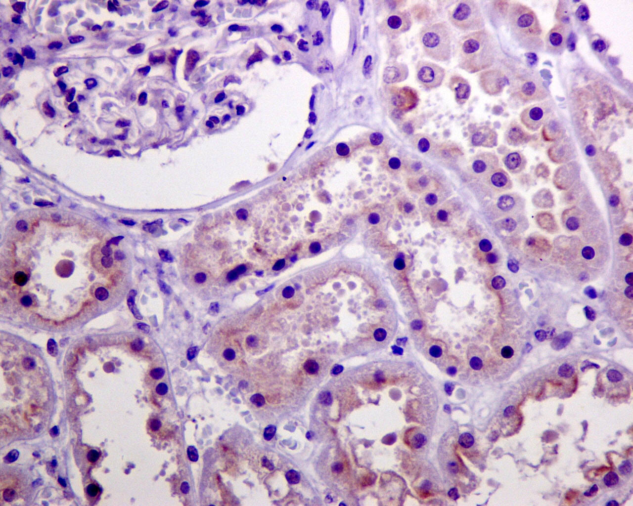 Akt(Phospho-Ser473) Rabbit mAb