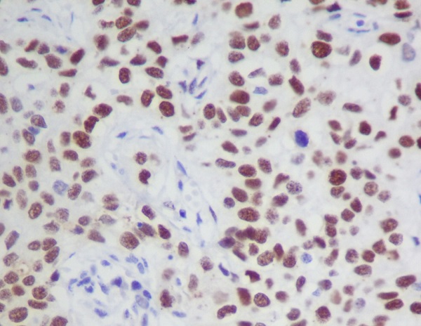 JAK2 (Phospho-Tyr1007/Tyr1008) Rabbit mAb