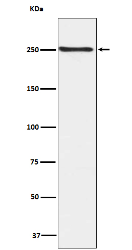 mTOR (Phospho-Ser2448) Rabbit mAb