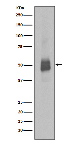 Lyn (Phospho-Tyr396) Rabbit mAb