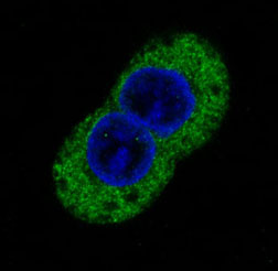 Phosphotyrosine Rabbit mAb