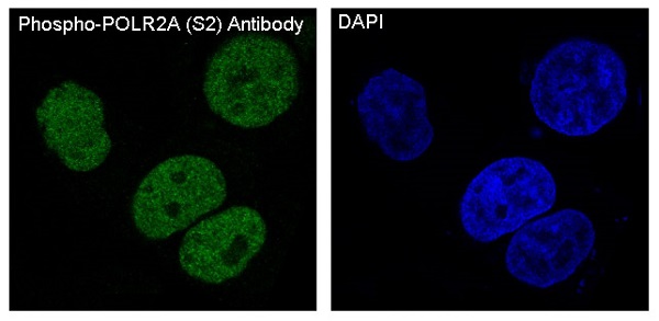 POLR2A (Phospho-Ser2) Rabbit mAb