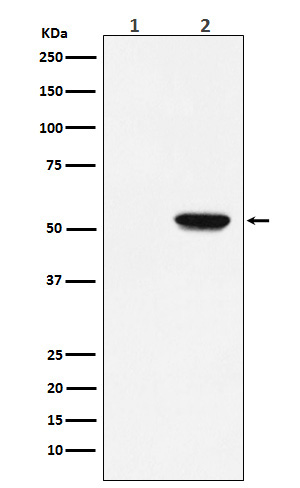 MLKL (Phospho-Ser358) Rabbit mAb