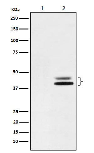 ERK1/2(Phospho-Thr202/Thr185) Rabbit mAb