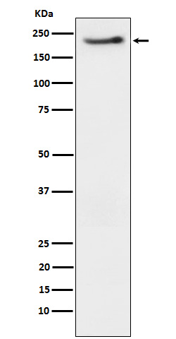 ErbB3 (Phospho-Tyr1222) Rabbit mAb