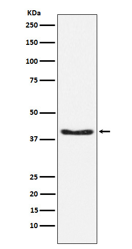 PDHA1 (Phospho-Ser293) Rabbit mAb