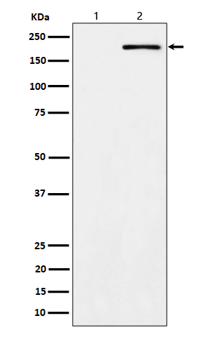 ErbB2 (Phospho-Tyr1139) Rabbit mAb