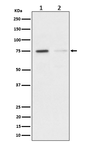 TAK1(Phospho-Ser439) Rabbit mAb