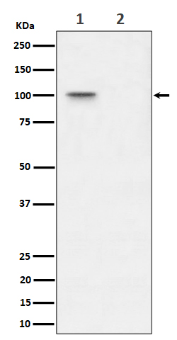 Nucleolin (Phospho-Thr76) Rabbit mAb