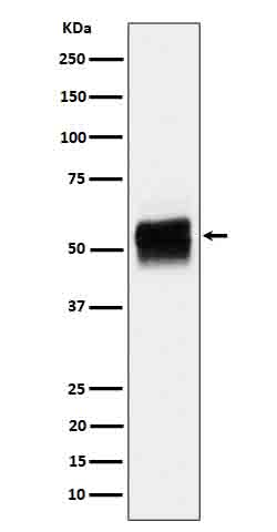 Tau (Phospho-Ser202) Rabbit mAb