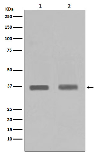PPP1CA+PPP1CB Rabbit mAb