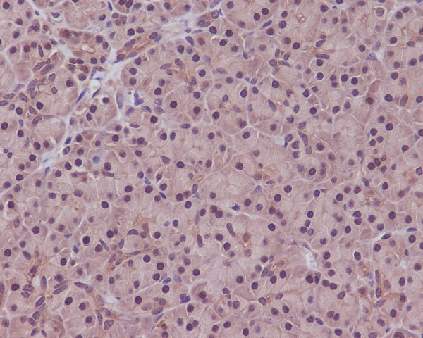 PPP1CA+PPP1CB Rabbit mAb