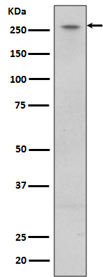 LRRK2  Rabbit mAb