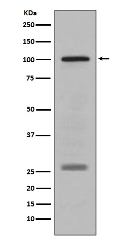 PMEL17 / GP100 Rabbit mAb