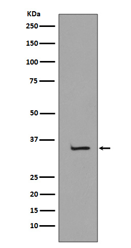 TBP Rabbit mAb 