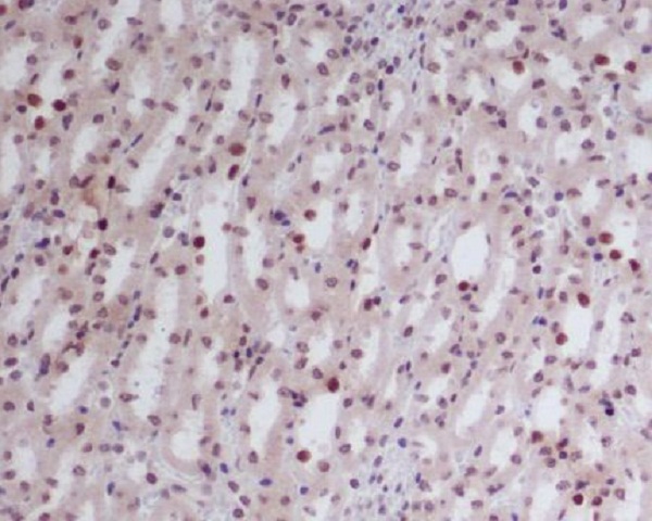 GATA2/3 Rabbit mAb