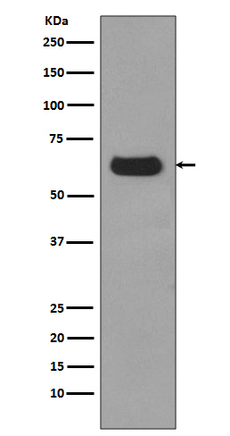 p62/SQSTM1 Rabbit mAb 