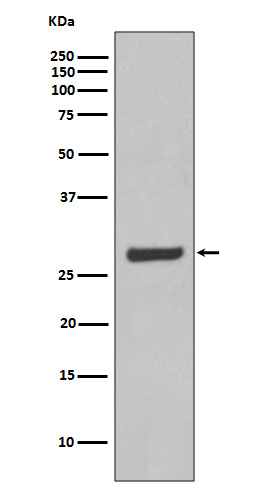 AQP5 Rabbit mAb