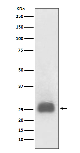 TIMP1 Rabbit mAb