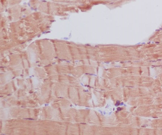 Myosin heavy chain Rabbit mAb