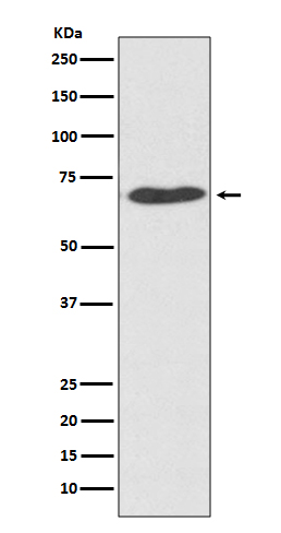 PDI Rabbit mAb