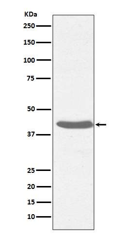 MHC class I Rabbit mAb