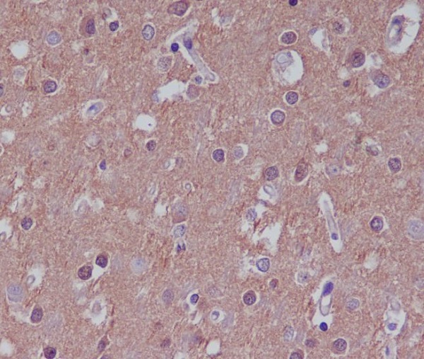 Substance P Rabbit mAb