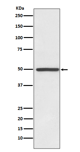 Dopamine Transporter Rabbit mAb