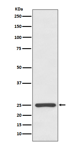 Kappa light chain Rabbit mAb