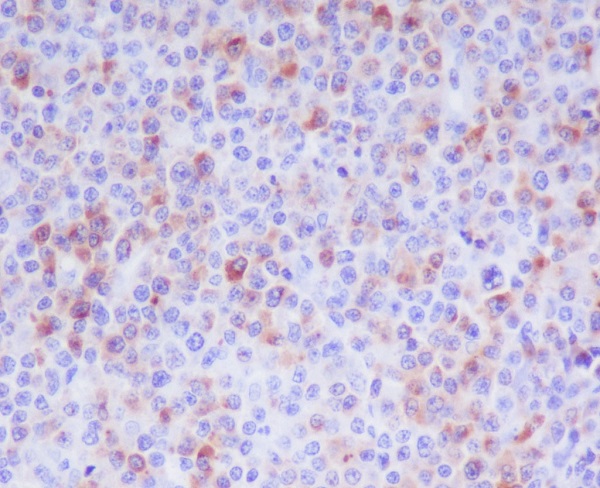 Granzyme B Rabbit mAb