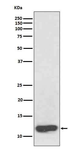 Serum Amyloid A Rabbit mAb