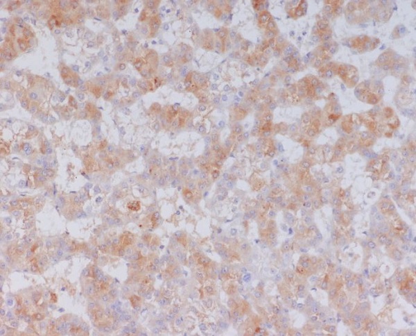 Serum Amyloid A Rabbit mAb