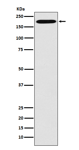 Clathrin heavy chain Rabbit mAb