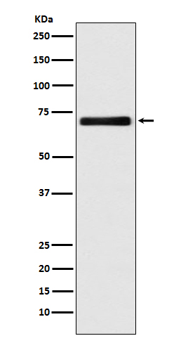 EAAT2 Rabbit mAb