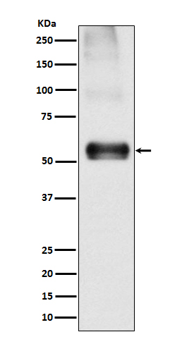 EAAT1 Rabbit mAb