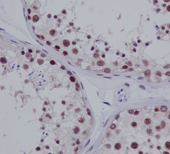 PIAS1 + PIAS2 Rabbit mAb