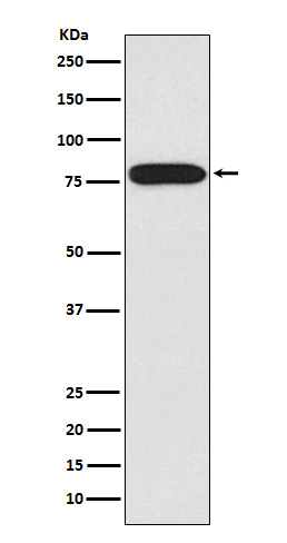 IRAK Rabbit mAb