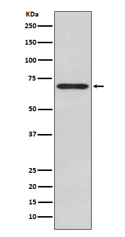 Glypican 3 Rabbit mAb