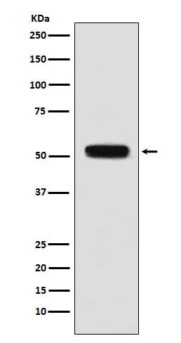 Fibulin 5 Rabbit mAb