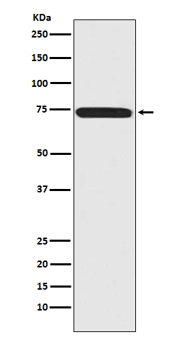 Menin Rabbit mAb